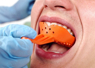 Zubna protetika otisak Default Title